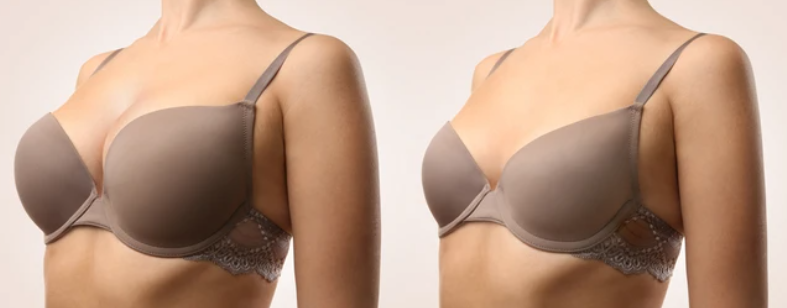 Customer before/after using Liftique